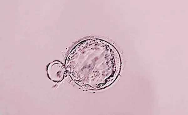 体外受精とは？