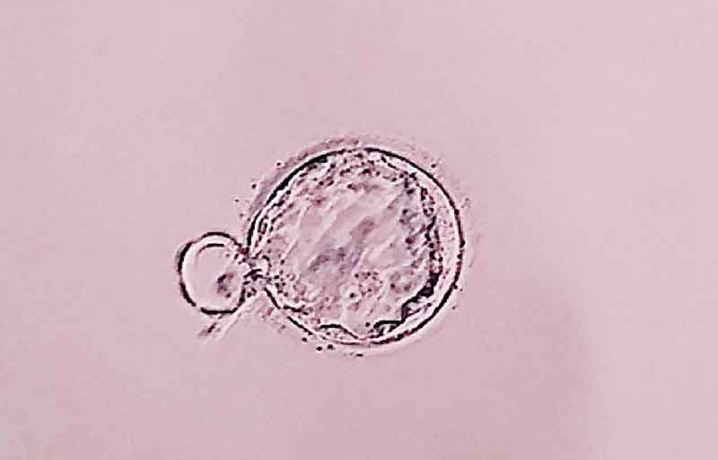 体外受精とは 年齢別に体外受精の妊娠確率を解説します 医師監修 ヒロクリニック