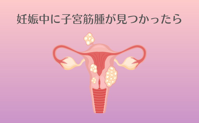 妊娠中に子宮筋腫が見つかったら 流産になる？