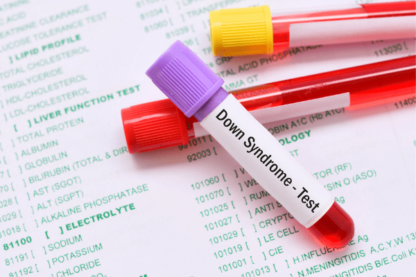 ダウン症の人に起こりやすい合併症と治療法