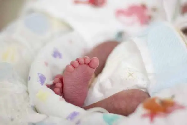 無呼吸発作の治療