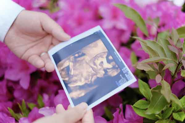 精細な超音波検査