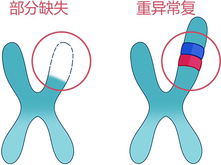 染色体缺失或者重复