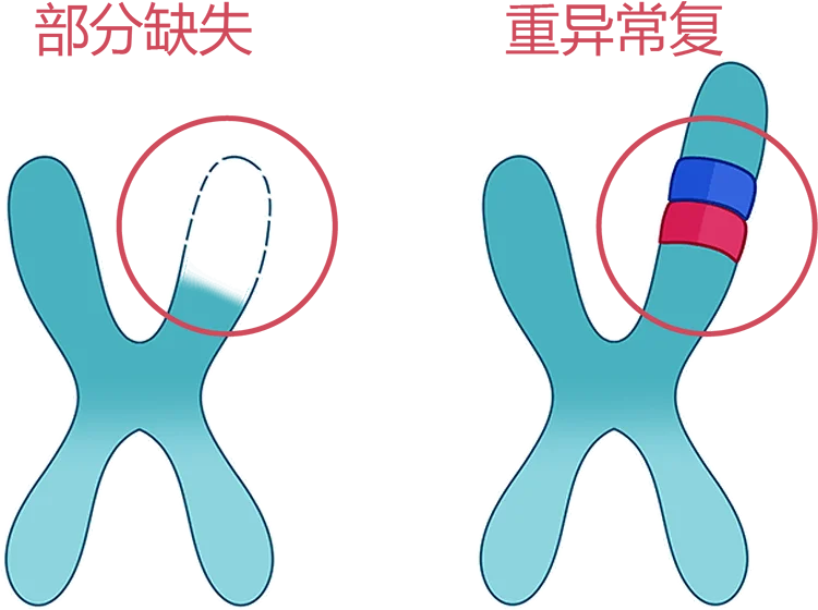 染色体缺失或者重复