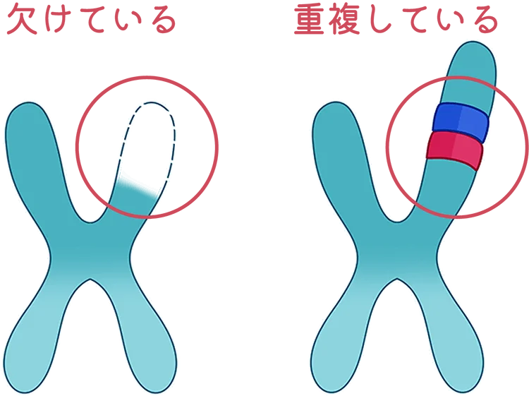 染色体がかけている重複している