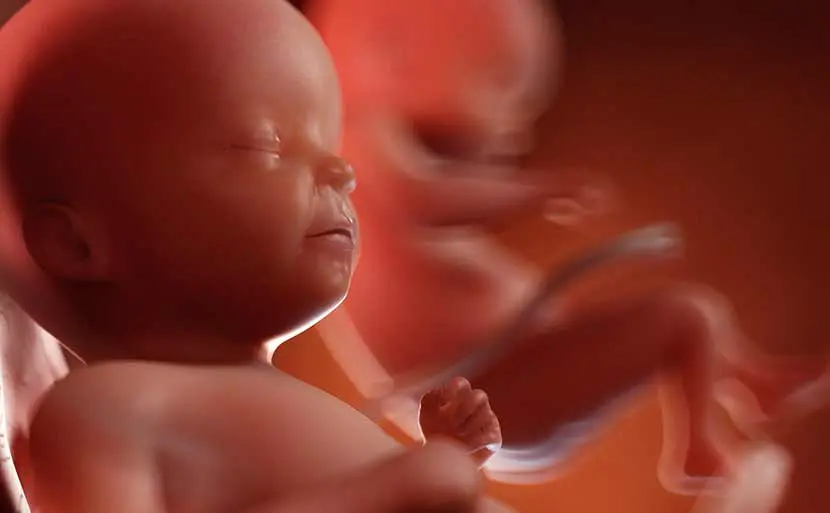 隠れバニシングツイン