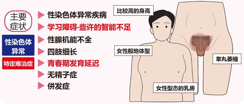 克莱因费尔特综合症