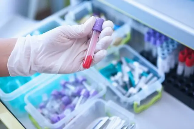 早期NIPT検査で発見できる微小欠失症候群とは？種類ごとの概要も併せて解説　ヒロクリニック　NIPT