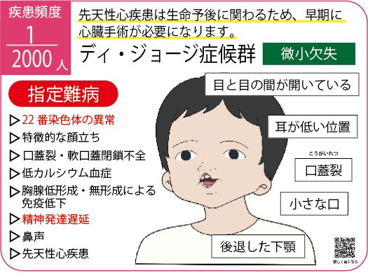 ディジョージ