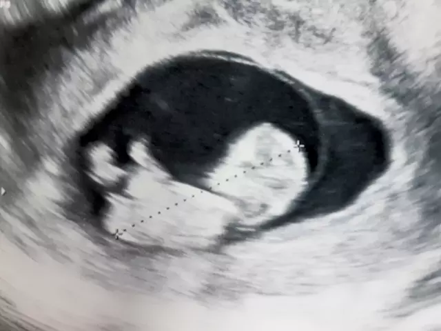 妊婦のエコー写真