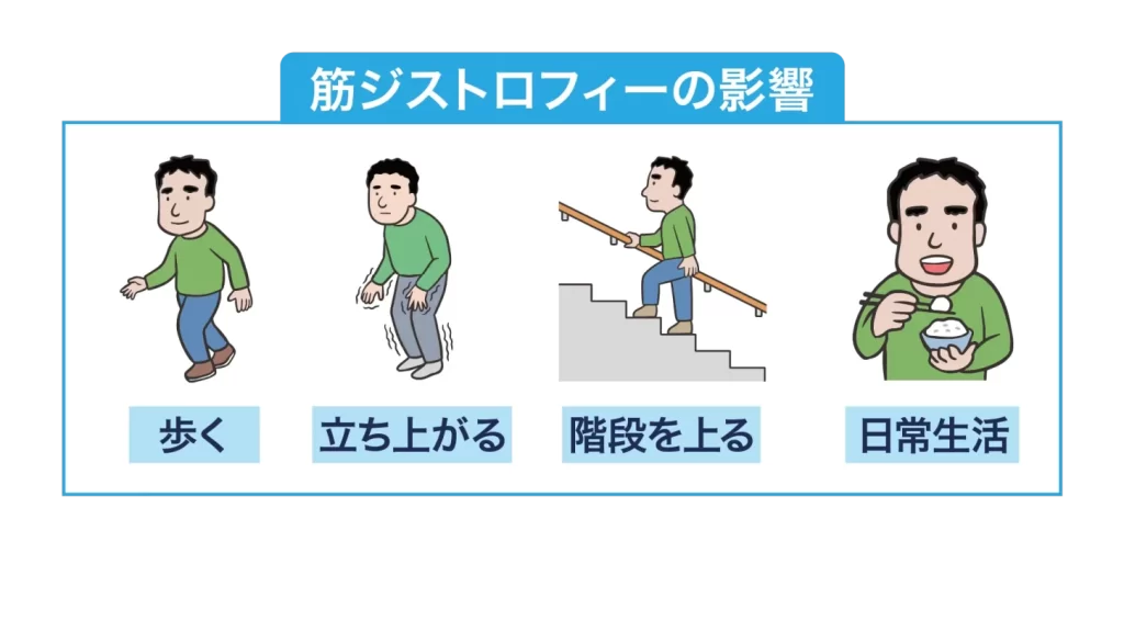 筋ジストロフィー