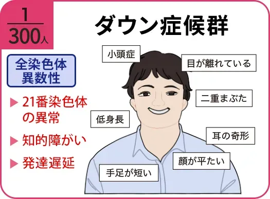 ダウン症