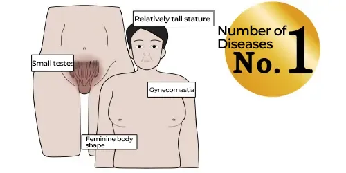 Klinefelter Syndrome