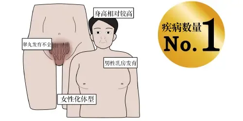 克氏综合征