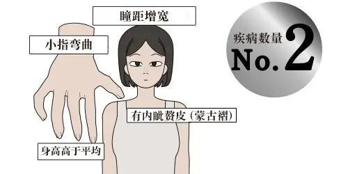 XXX综合征