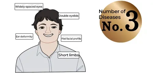 Down Syndrome