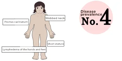 Turner Syndrome