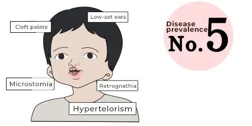 DiGeorge Syndrome