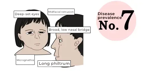 1p36 Deletion Syndrome