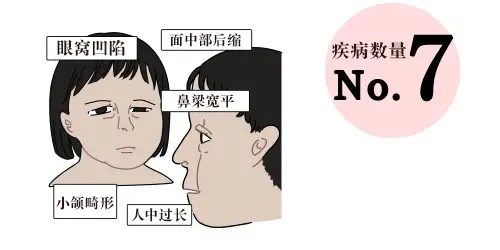1p36缺失综合征