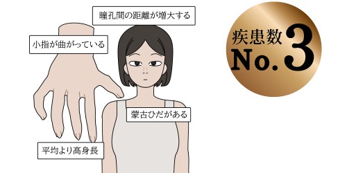 XXX症候群(47,XXX)の説明イラスト