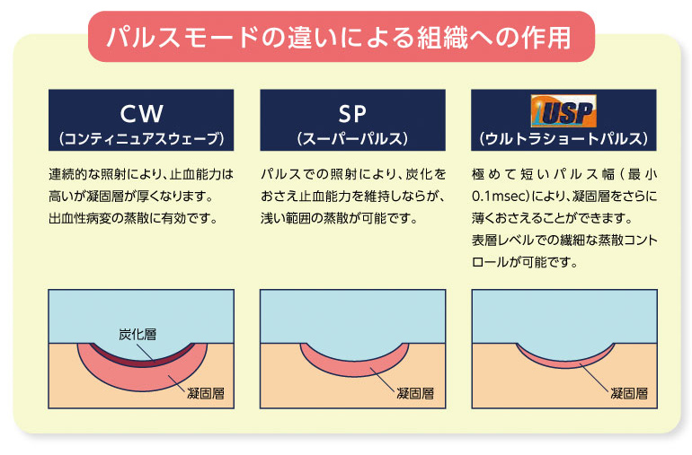 パルスモードの違いによる組織へのの作用