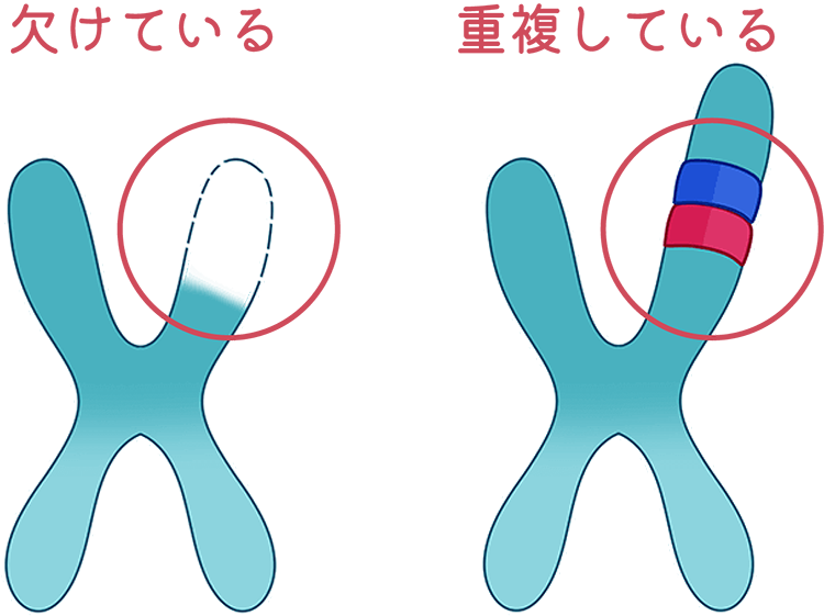 染色体がかけている重複している