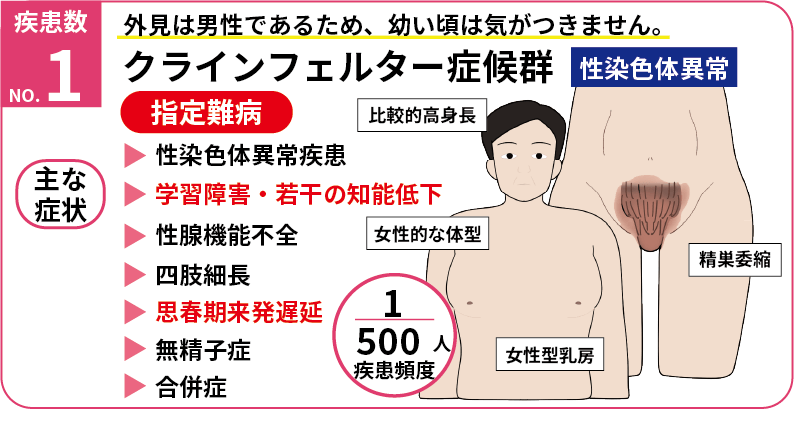 クラインフェルター