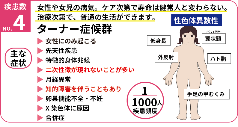 ターナー