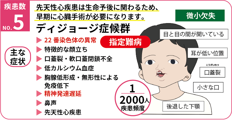 ディジョージ