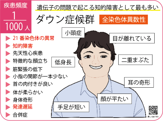 ダウン症