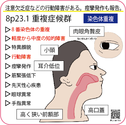 重複