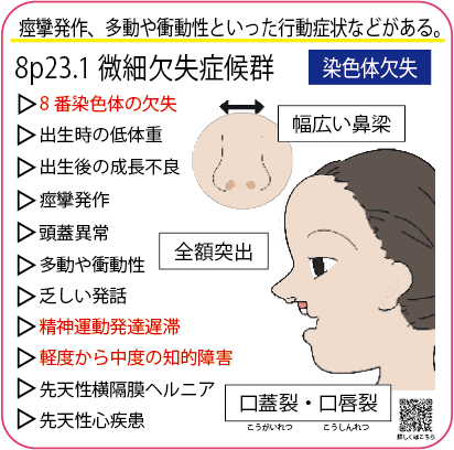 微小欠失